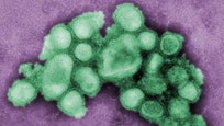 British and Chinese scientists have found a genetic variant which explains why Chinese populations may be more vulnerable to the HN virus, commonly known as swine flu